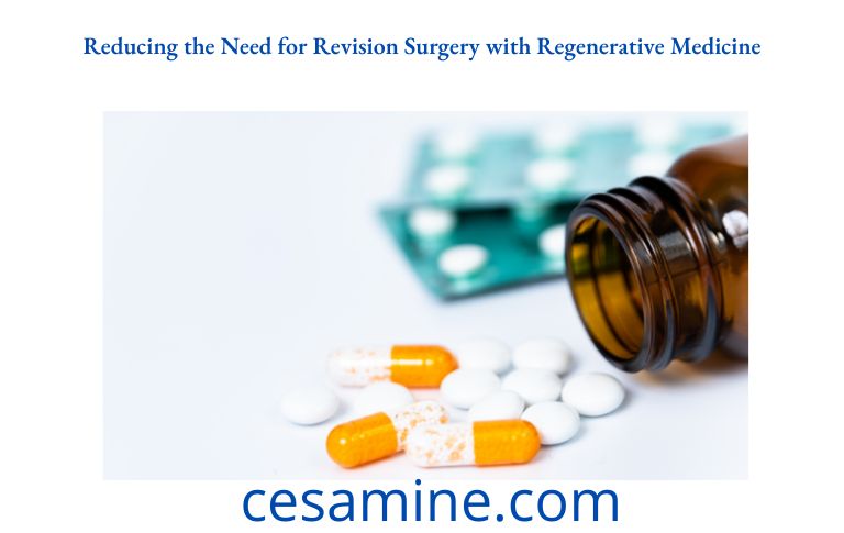 Reducing the Need for Revision Surgery with Regenerative Medicine