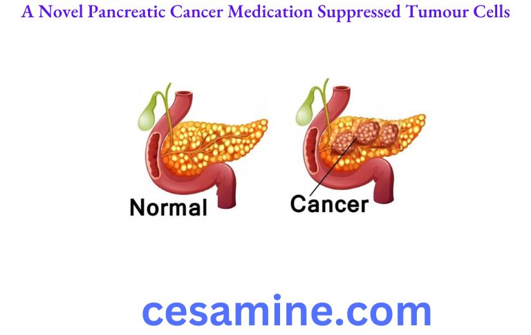 A Novel Pancreatic Cancer Medication Suppressed Tumour Cells