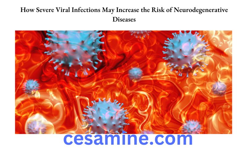 How Severe Viral Infections May Increase the Risk of Neurodegenerative Diseases