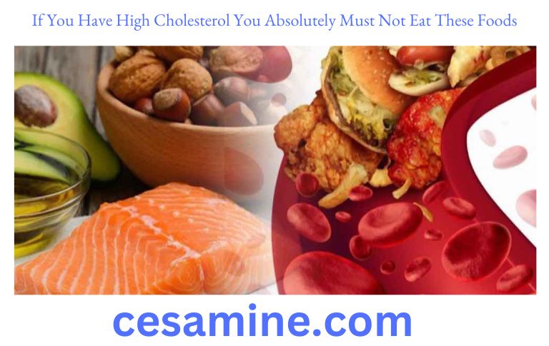 If You Have High Cholesterol You Absolutely Must Not Eat These Foods