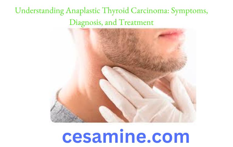 Understanding Anaplastic Thyroid Carcinoma