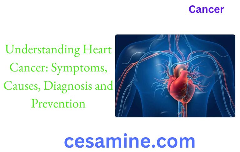 Understanding Heart Cancer