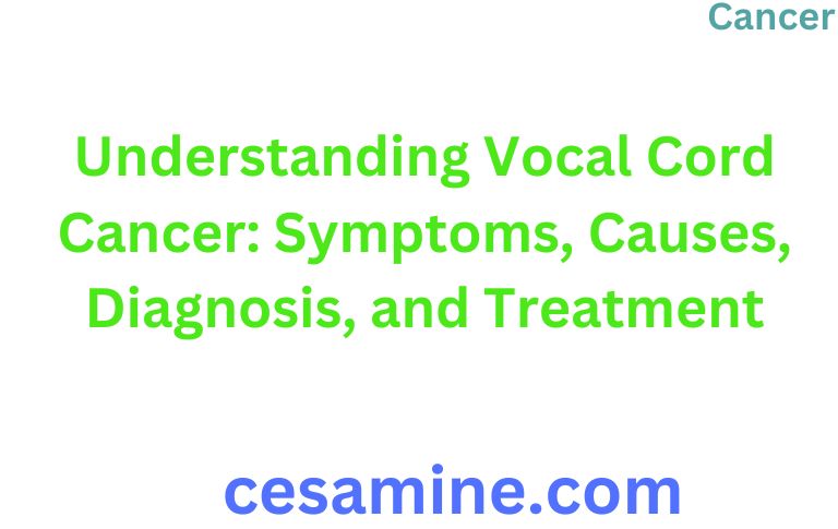 Understanding Vocal Cord Cancer